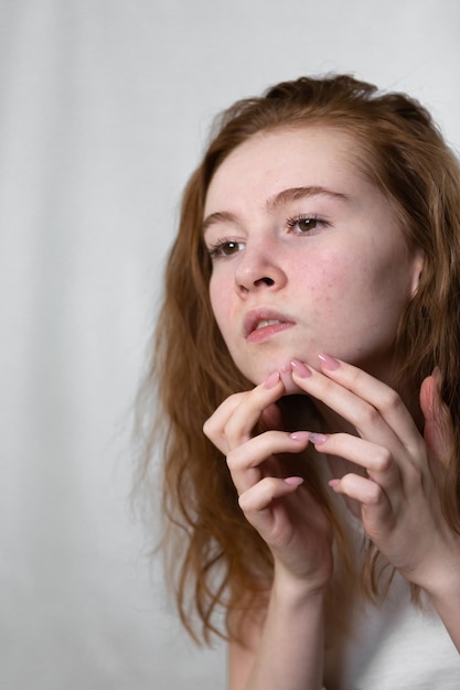 A young teenage girl squeezes out pimples on her face by\
looking in the mirror