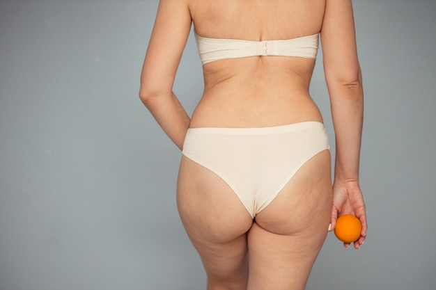 Young woman holding an orange on a light background Cellulite problem concept