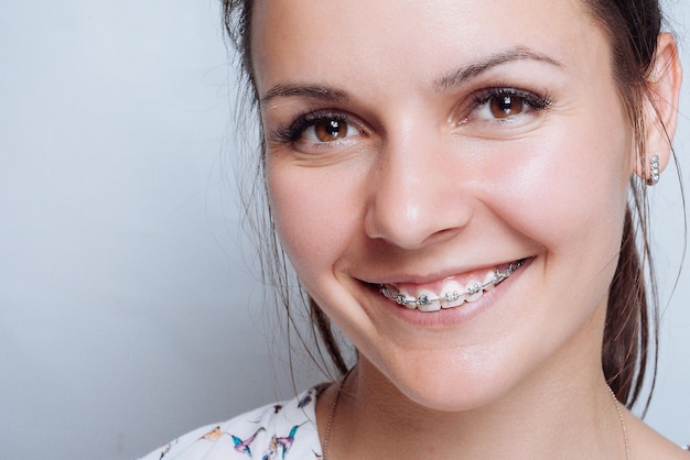 Photo young woman portrait with dental braces natural