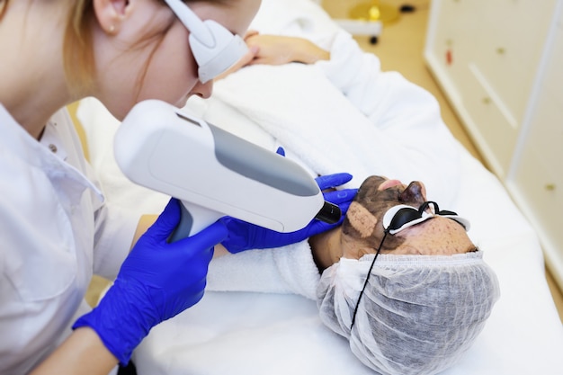 A young woman on the procedure of carbon peeling on the surface of modern cosmetology room. Laser cosmetology