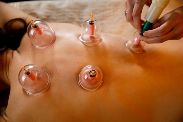 A young woman relaxes in a massage parlor vacuum cups of medical cupping therapy on woman back close