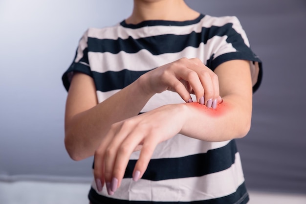 Young woman scratching her itchy arm