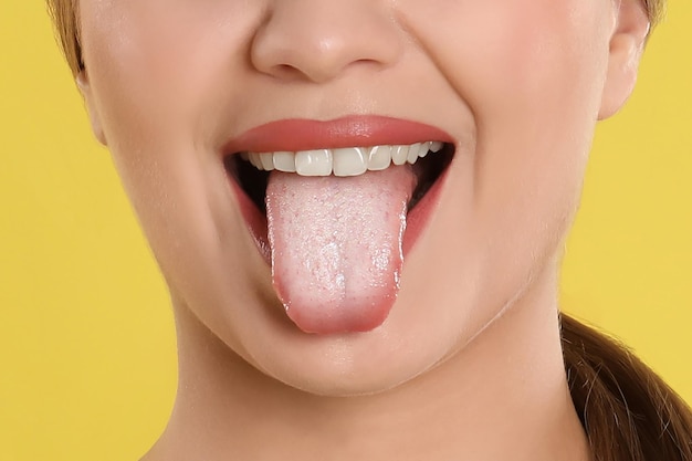 ゼニス新作モデル young-woman-showing-tongue- 健康・医学