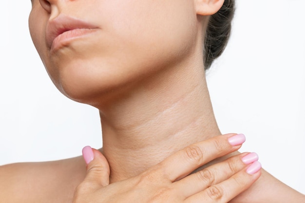 Young woman touching her neck with her hand. Lines on the neck. Wrinkles, age-related changes