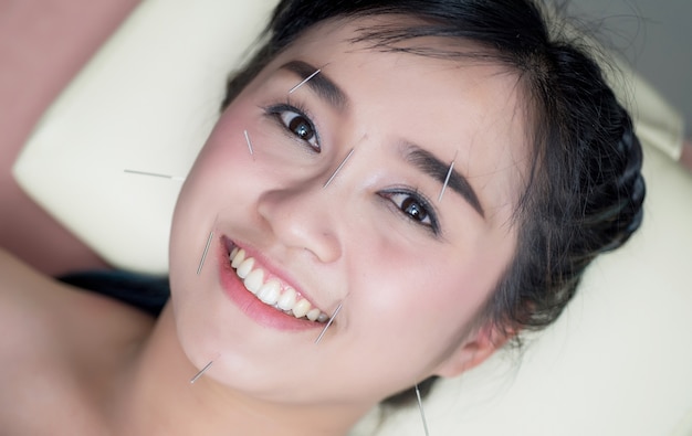 Young woman undergoing acupuncture treatment