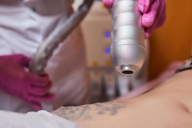 Young woman undergoing laser tattoo removal procedure in salon closeup