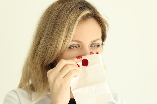 Young woman wipes nose with napkin stopping bleeding sick blonde female suffers from high blood