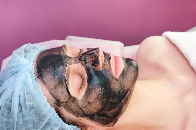 Young woman with carbon nanogel on her face in salon. Peeling procedure.
