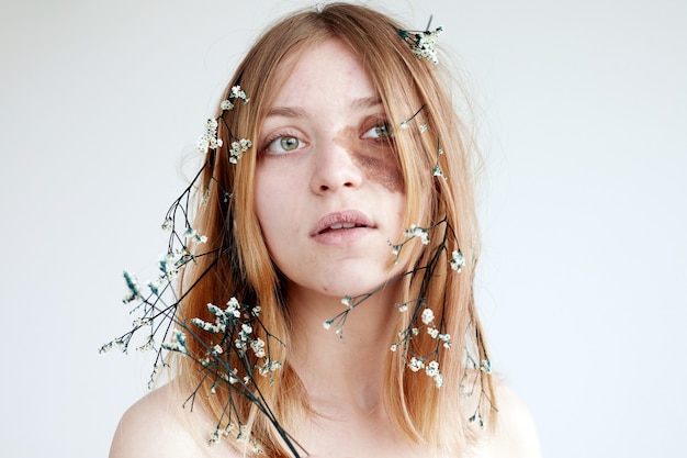 Young woman with dark spot on face and flowers