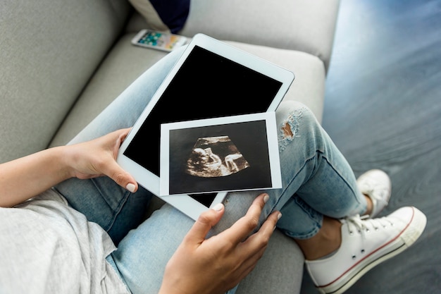 Young woman with ecography and tablet