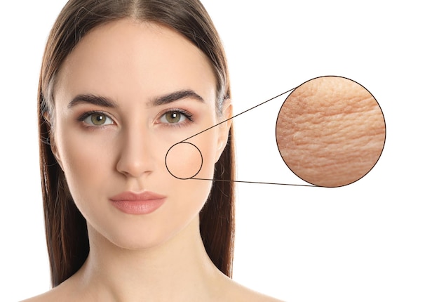 young woman with skin problem on white background
