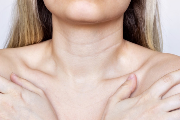 A young womans neck and chest Lines on the neck