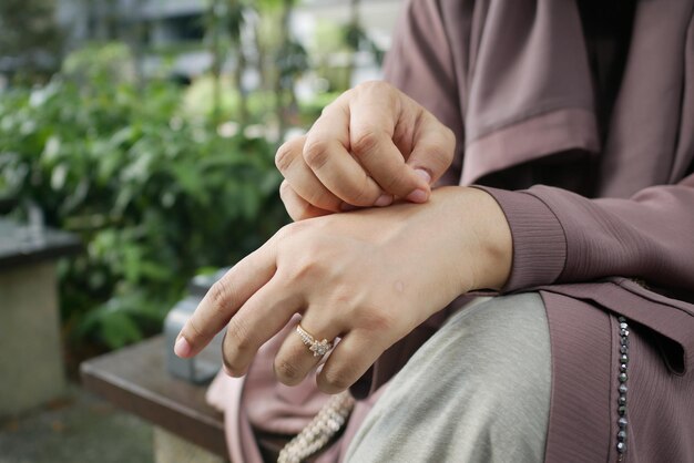 Young women suffering from itching skin sitting on bench in a park