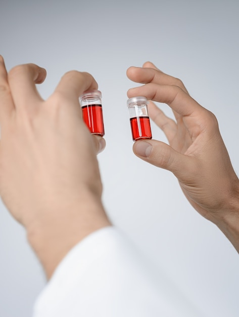 Ywo liquid samples in male hands