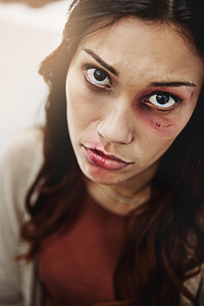 Zal niemand me helpen Bijgesneden portret van een geslagen en gekneusde jonge vrouw