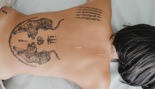 Zenithal view of the back of a tattooed woman with acupuncture needles stuck in her back