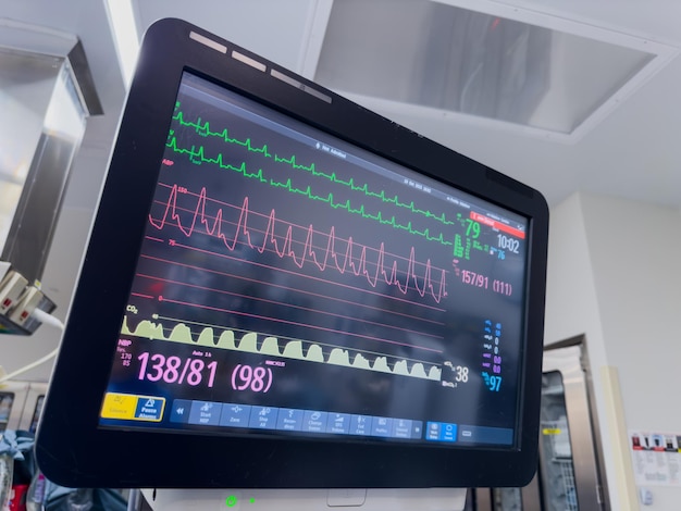 ziekenhuismonitor die vitale functies, hartslag, bloeddruk, temperatuur en pulsoximetrie weergeeft