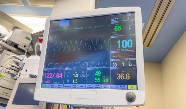 Ziekenhuismonitor een symbool van de vitale functies van de gezondheidszorg en het welzijn van de patiënt die de bloedpres