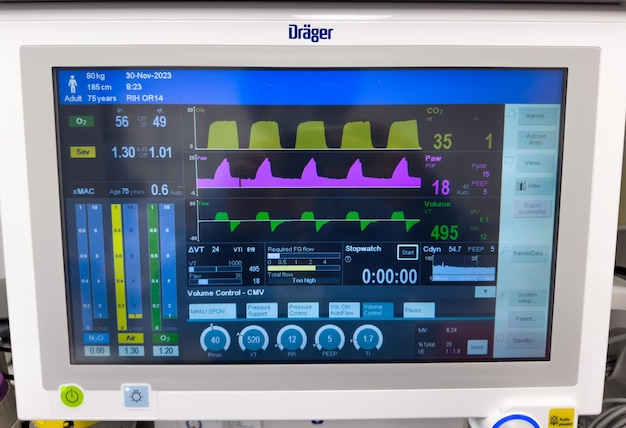 Foto ziekenhuismonitoren tonen vitale tekenen hemodynamica hartslag bloeddruk temperatuur zuurstof