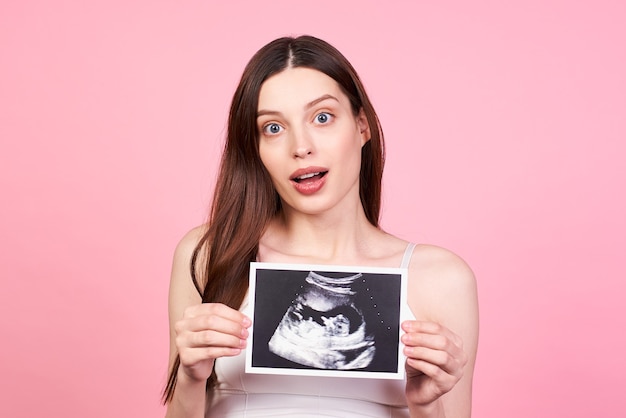 Zwangere jonge vrouw met haar kind echografie. Verrast aanstaande moeder, genietend van de eerste foto van haar ongeboren kind, anticiperend op haar toekomstige leven, roze studioachtergrond.