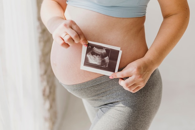 Foto zwangere vrouw die een sonogram houdt