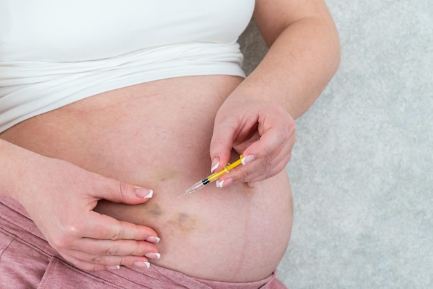 Zwangere vrouw die injectie doet in de maag met blauwe plekken.