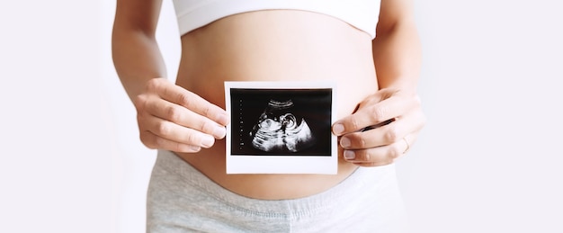 Zwangere vrouw met echografie baby afbeelding zwangere buik en echo foto in handen van moeder