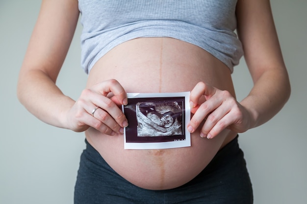 Zwangere vrouw met echografie