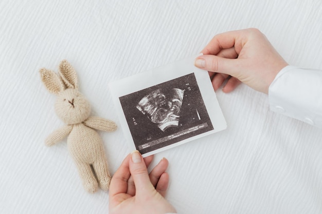 Zwangerschap echografie foto. Baby eerste echo foto. Sonogram foto. Nieuw leven concept