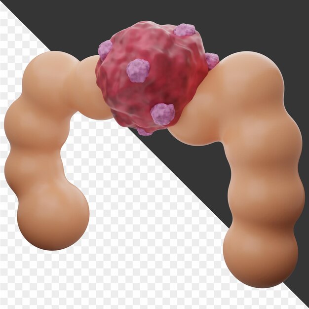 PSD illustrazione 3d del cancro