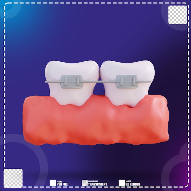 PSD 3d ilustracja noszenia aparatów ortodontycznych 3