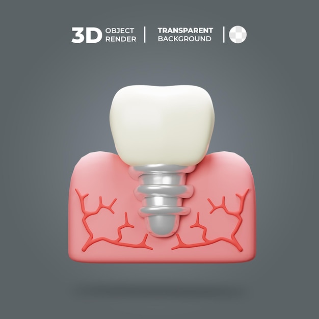 PSD 3d 임플란트 치아 아이콘