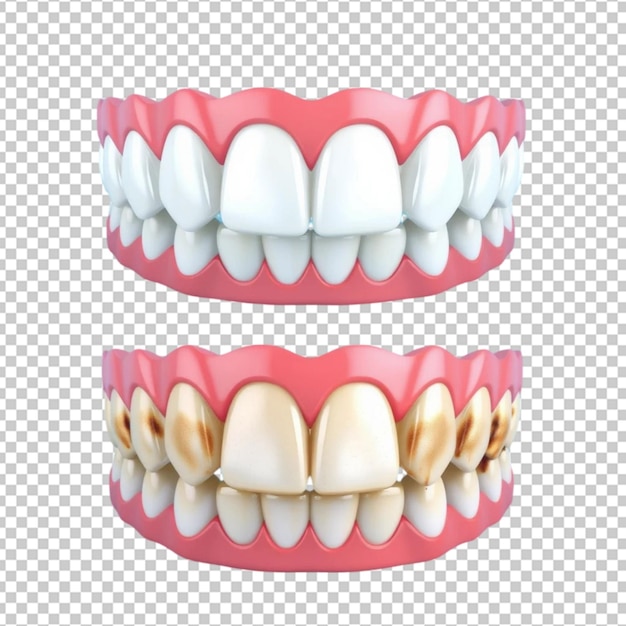 3D-реалистичный набор с одним рядом чистых блестящих зубов и другим рядом окрашенных грязных зубов на синем фоне