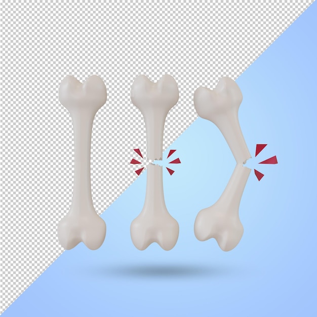 PSD 3d rendering of broken bones in different stages, psd file