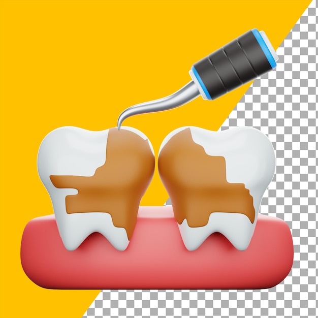 PSD 3d tooth scaling treatment