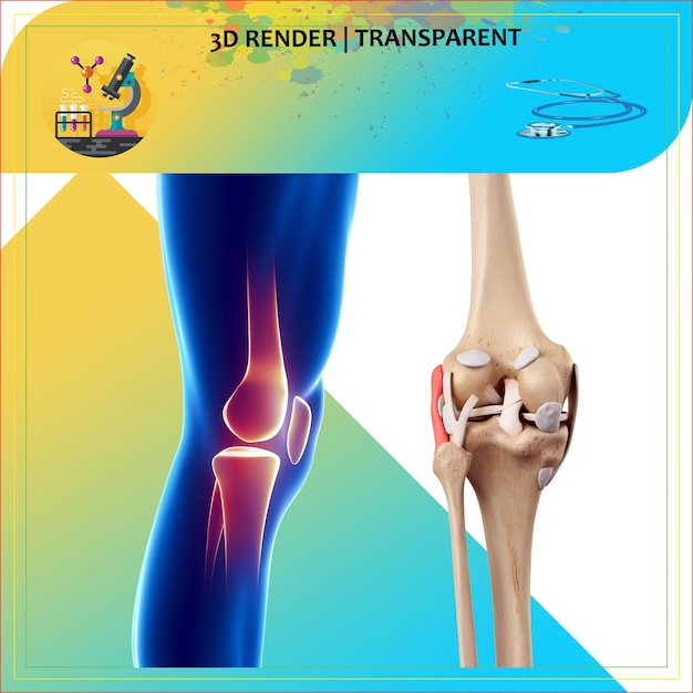 a picture of a knee and knee that says 3d printed on it