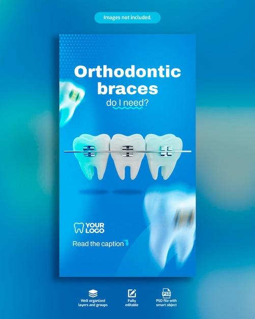 PSD Плакат для стоматологии с письменными зубными брекетами и элементами брекетов для зубов