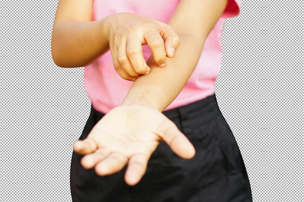 Asian woman having itchy skin on arm