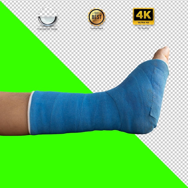 Blue Cast on Broken Leg