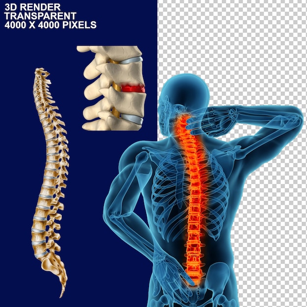 PSD ból stawów ból pleców ból stavów ból szyi ból kolan ból górnej części pleców dolna część pleców szkielet mózgu