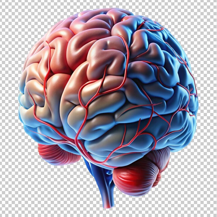 PSD brain structures
