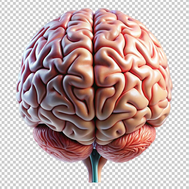 PSD brain structures