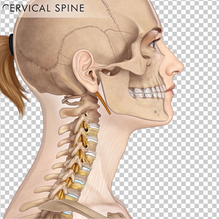 PSD the cervical spine neck region