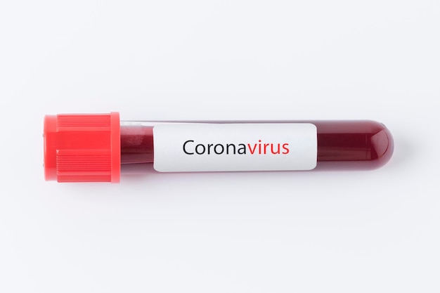 Coronavirus bloedonderzoek buis