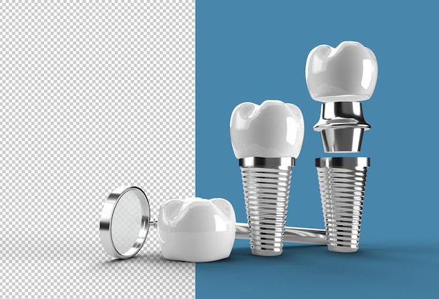 Dental Implants surgery concept Transparent PSD File.