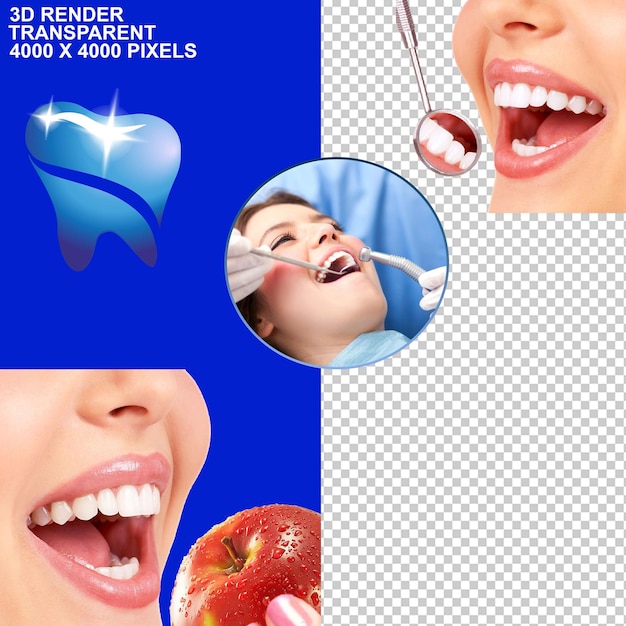 Trattamento dentale tessere dentale implant dentale osservazione dentale controllo dentale dolore dentale dentista