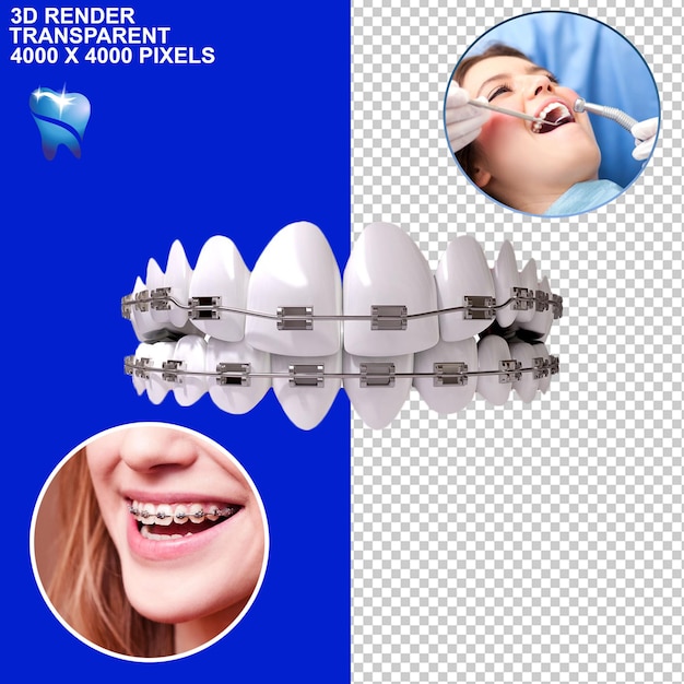 Trattamento dentale tessere dentale implant dentale osservazione dentale controllo dentale dolore dentale dentista