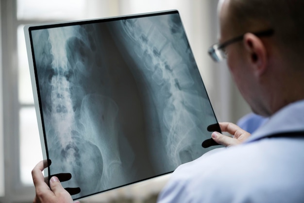 Doctor with a patient39s xray film