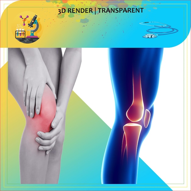 Een poster voor een 3D-model toont de knie en het been van een vrouw.
