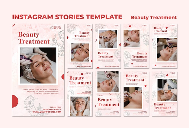 PSD historie na instagramie dotyczące zabiegów kosmetycznych